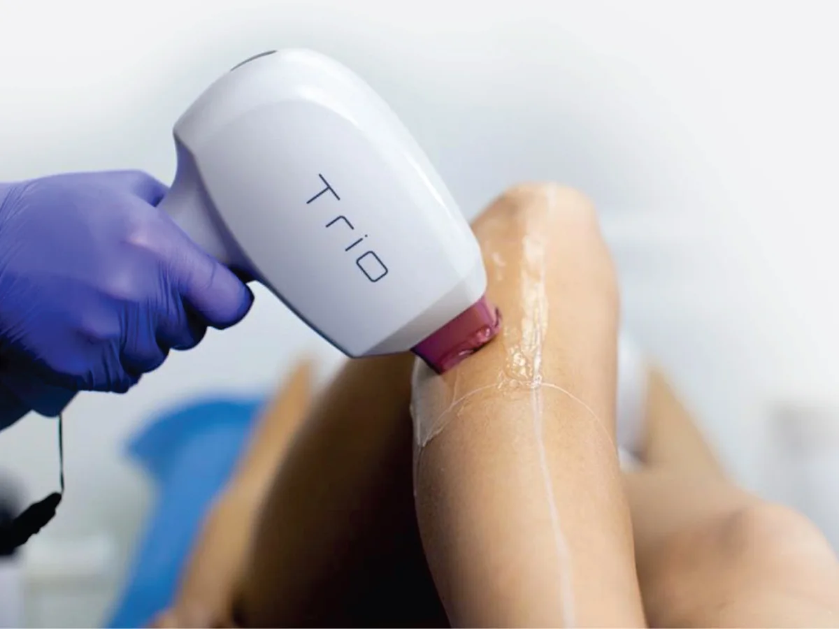 Coolite BOLT Trio handpiece being used for laser hair reduction on a patient's leg