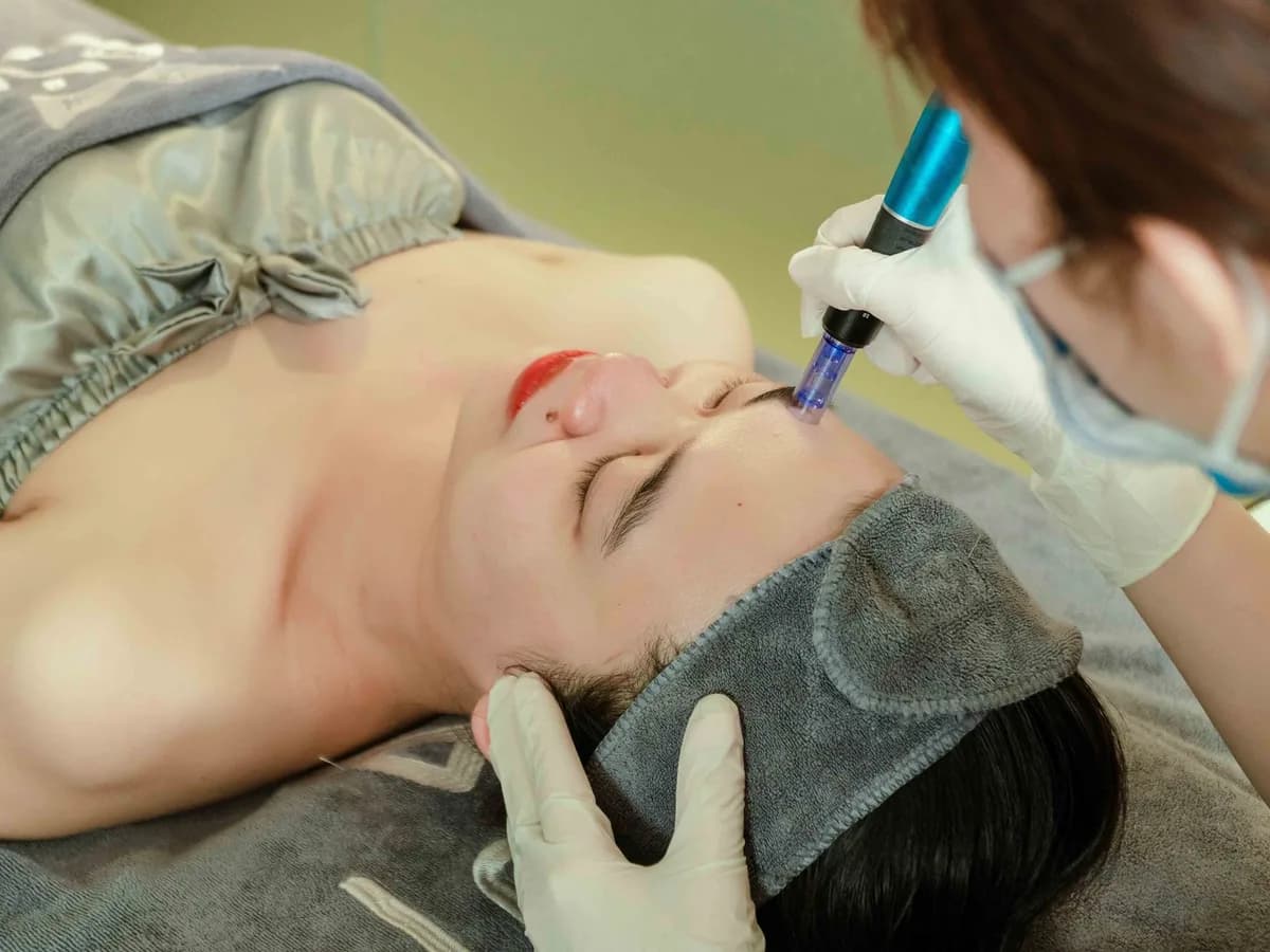 Close-up of a microneedling pen device being used on a patient's face